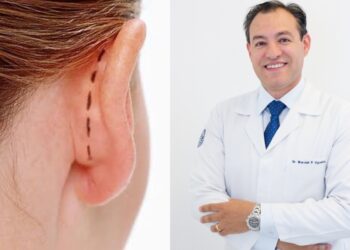 Otoplastia: Dr. Wendell Uguetto explica procedimento para correção de orelhas